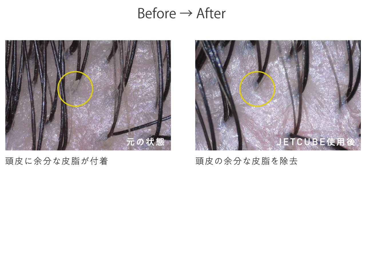 元の状態とJETCUBE使用後の頭皮の写真