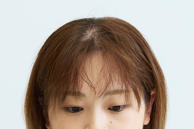 寝ぐせの直し方01