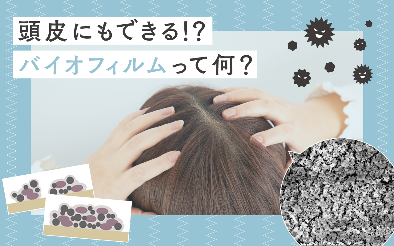 頭皮にもできる？！バイオフィルムって何？